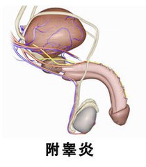 运城泌尿男科医院介绍:附睾炎的日常护理